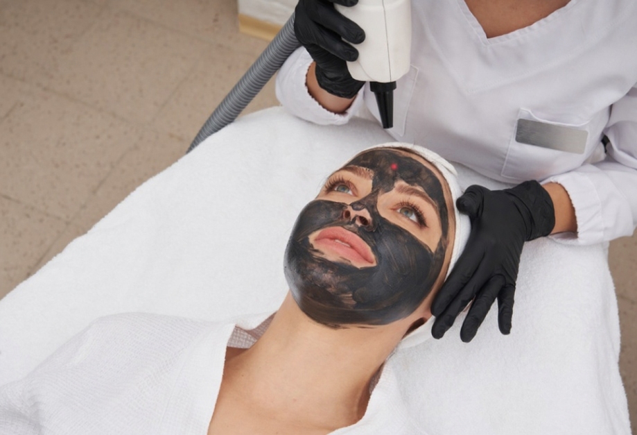 Carbon Laser Facial
