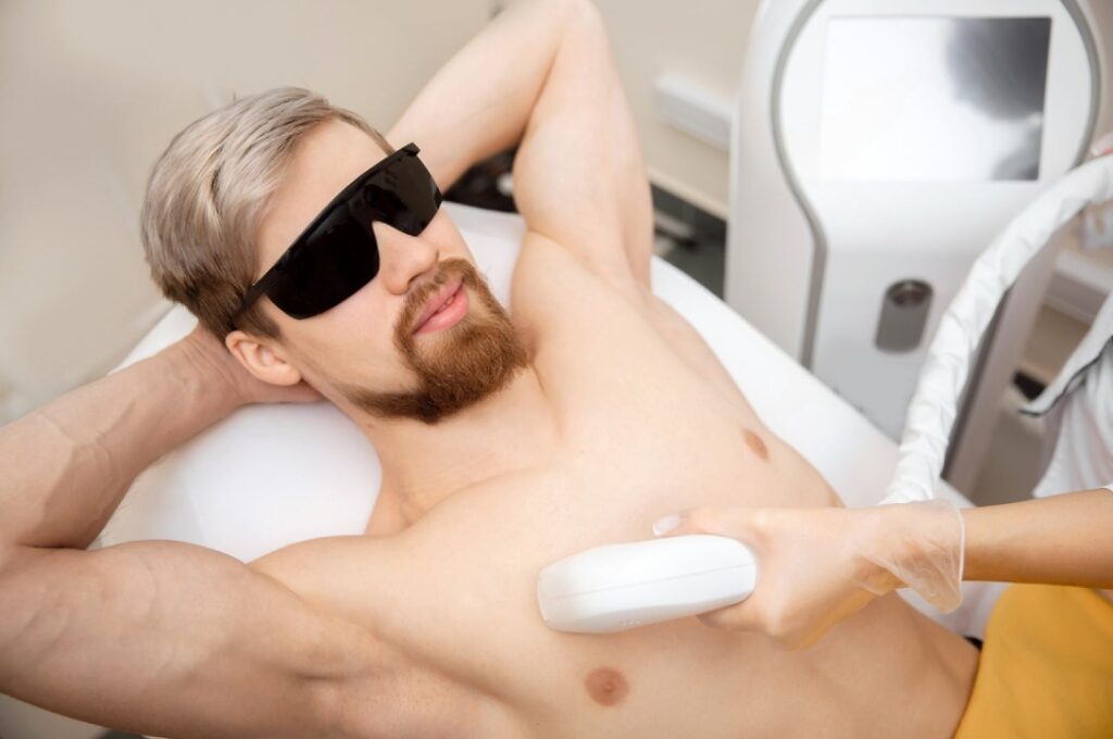 Chest Laser Hair Removal