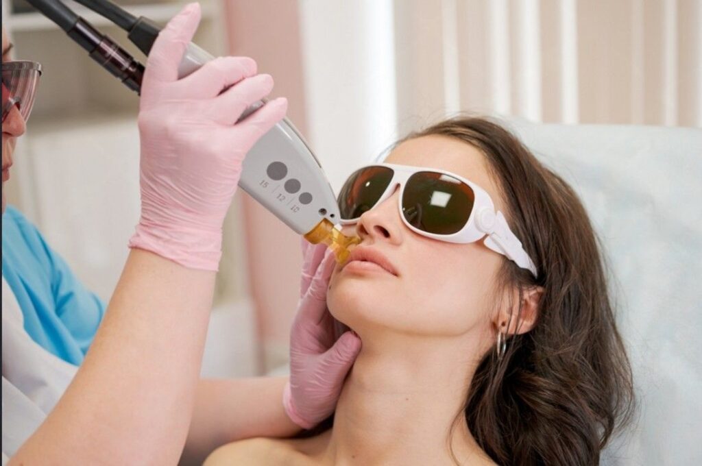 Face Laser Hair Removal