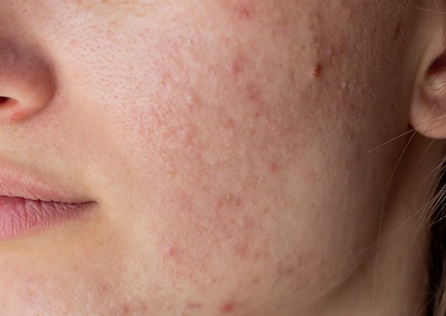 Skin Care Clinic Skin Care Clinic