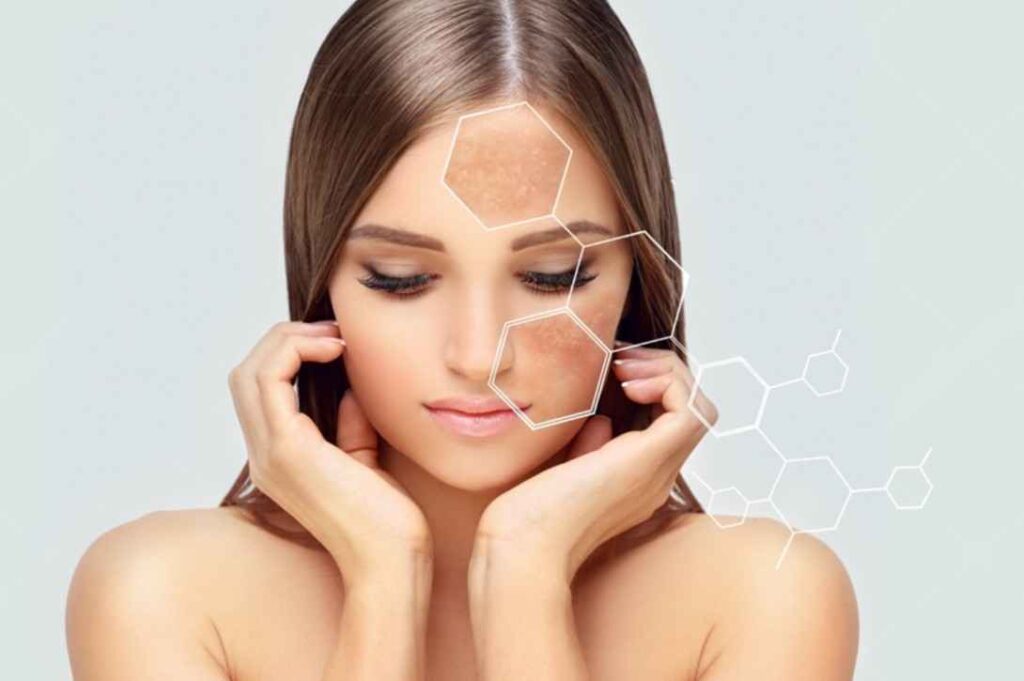 Reduction in pigmentation