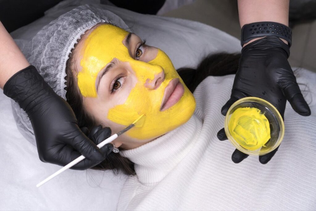 Yellow Peel Treatment