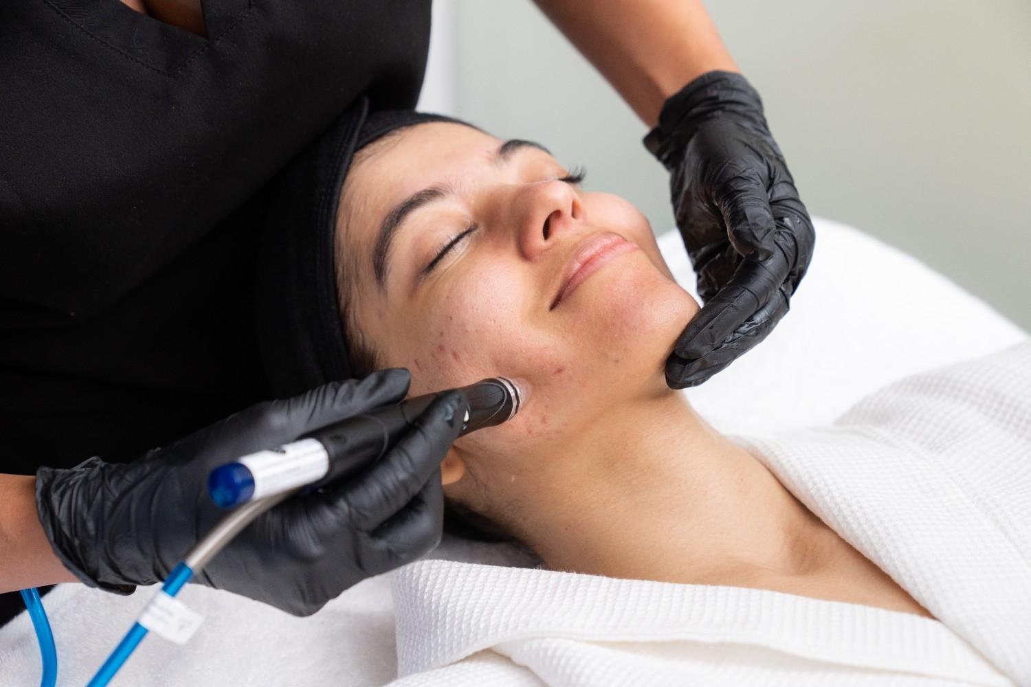 Hydrafacial Treatment